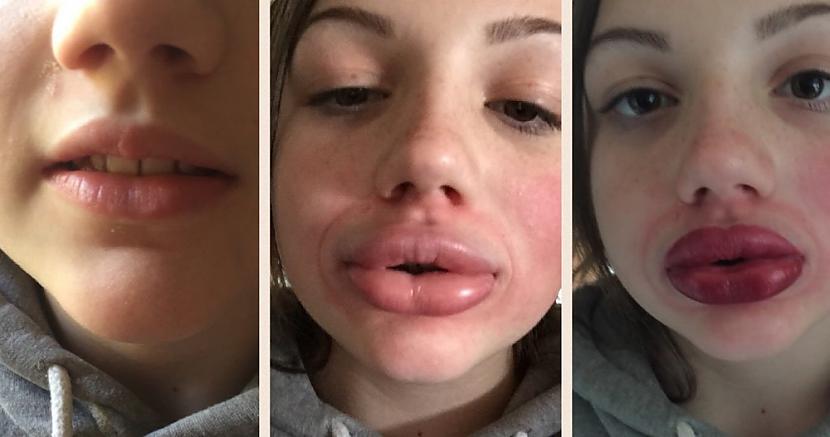 nbspKailijas Dženeras lūpu... Autors: matilde 10 ķermeņa izaicinājumi, kas bija populāri internetā