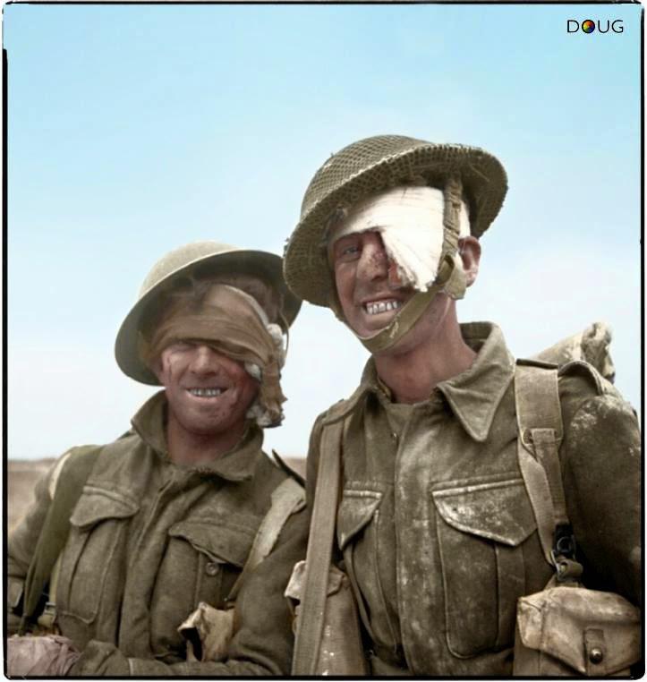 Ievainotie kareivjinbspMareta... Autors: Lestets 2. pasaules kara bildes, kas pārsteigs!