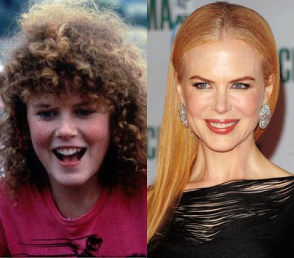 Nicole Kidman Autors: StarGirl83 Slavenības: pirms un tagad