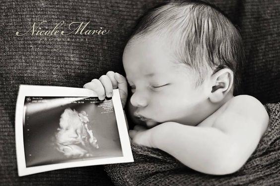  Autors: ALISDZONS Birth photography