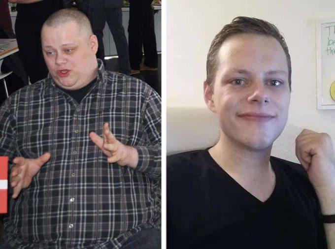 Mīnus 63 kilogrami Autors: chikooorita Neticami piemēri tam, kā cilvēku sejas mainās pēc svara zaudēšanas