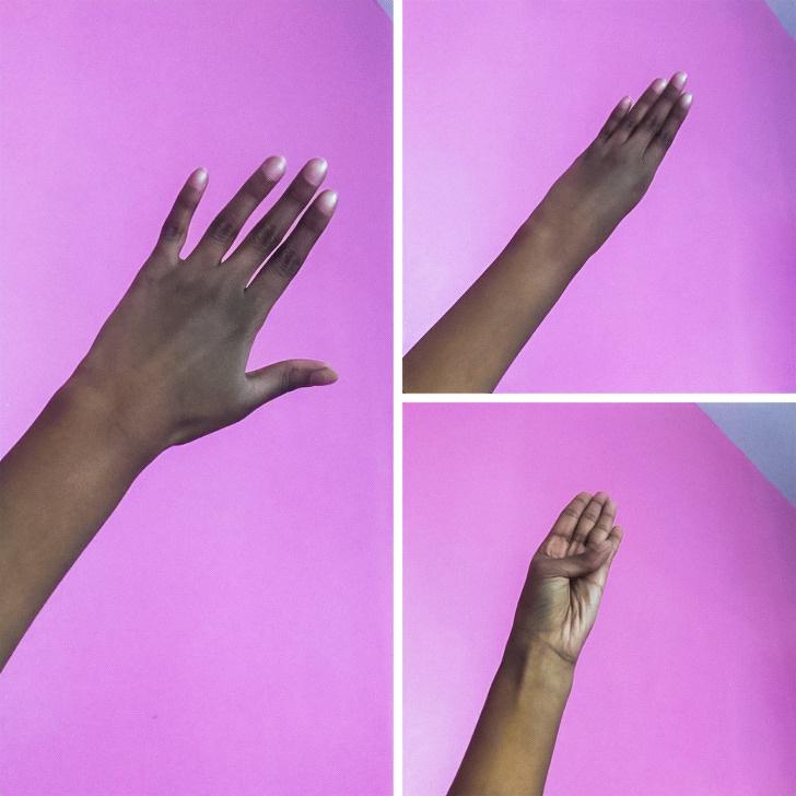 laquoMani roku pirksti ir tik... Autors: matilde Interesanti: 19 cilvēki, kuri nekautrējas parādīt savas nepilnības