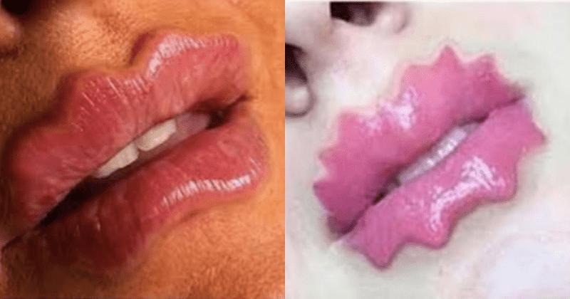 Lai gan vairākos avotos tiek... Autors: matilde «Velna lūpas», iespējams, ir neglītākais skaistuma trends, kāds jebkad ir bijis