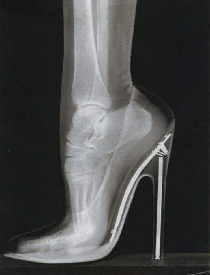 Sievietes pēdas kauli kad viņa... Autors: The Diāna 18 forši rentgeni redzesloka paplašināšanai