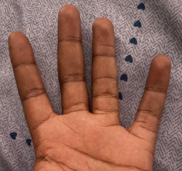 quotManam pirkstam ir vairākas... Autors: Lestets 19 attēli, kas pierāda, cik ļoti pārsteidzošs ir cilvēka ķermenis