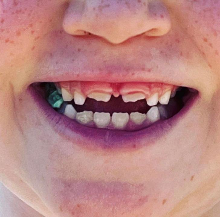 Sescarongadnieka zobi kuriem... Autors: The Diāna 22 reizes, kad cilvēki padalījās ar redzēto