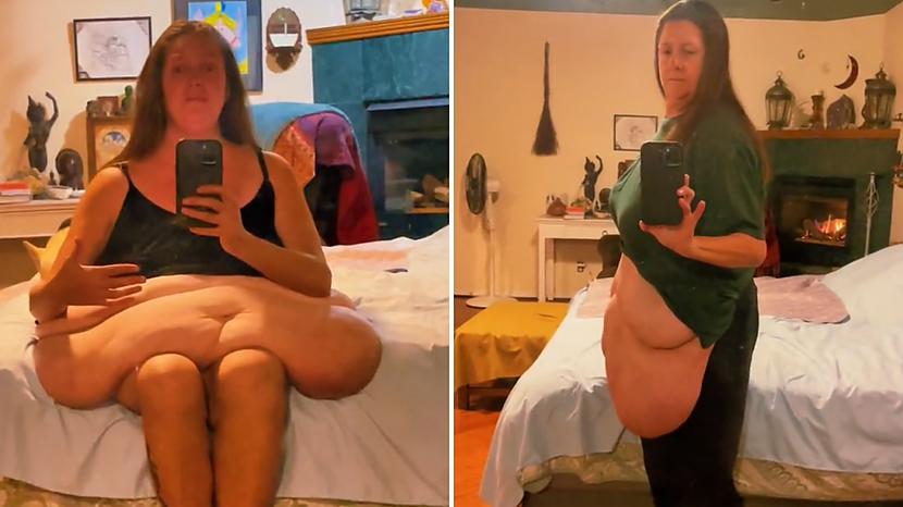 Terēza savos sociālajos tīklos... Autors: matilde VIDEO ⟩ Sieviete parāda, kā izskatās ķermenis pēc zaudētiem 165 kilogramiem